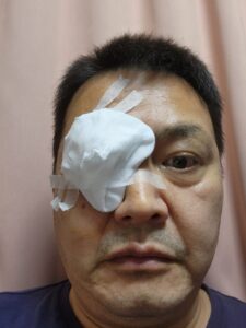 右目の手術・黄斑上膜と白内障・アトリエミカ・高校生の教室・学校スタジオ・学校撮影・ミュージックビデオ撮影現場・撮影スポット・学園ドラマ・コマーシャル撮影・CM撮影・映画撮影・再現ドラマ撮影・コスプレ撮影・ユーチューブ撮影・アトリエミカミ・管理運営・学校撮影・レンタルスタジオ・東京近郊・東京・東京・関東・桜川市・真壁町・撮影専用物件ミ・ハウススタジオ・学校スタジオ